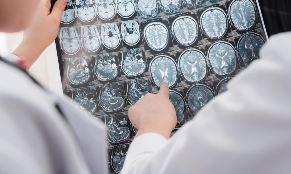 neuroplasticidad en el envejecimiento